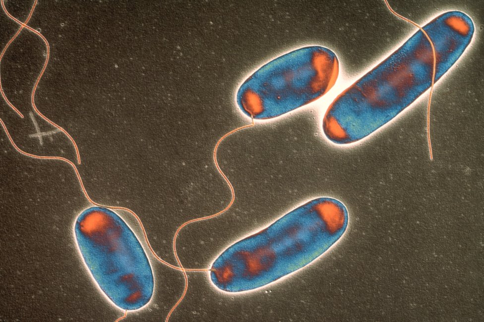 Бактерии легионеллы. Цветная трансмиссионная электронная микрофотография (ПЭМ) среза бактерий Legionella pneumophila, вызывающих болезнь легионеров.