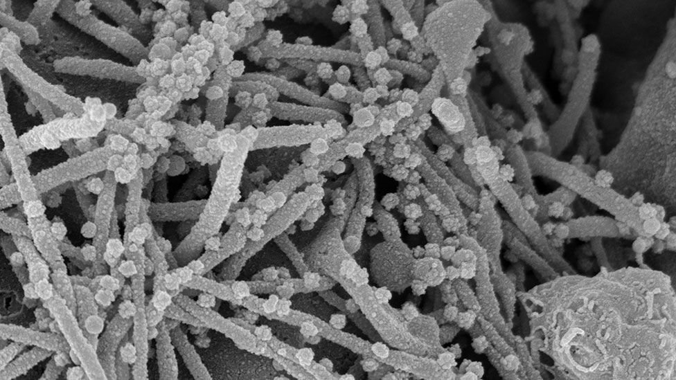 Imagem microscópica em preto e branco mostra filamentos e bolinhas de vírus
