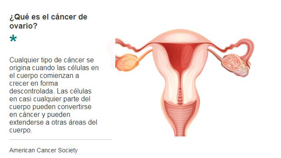 Explicación sobre el origen del cáncer de ovarios