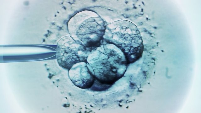 IVF treatment under the microscope