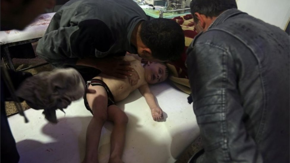 Ребенок лечился в Думе после подозрения на химическую атаку (07.04.18)