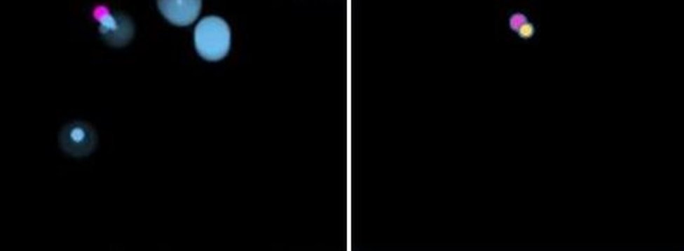 Изображение слева показывает цель (розовый) и точки контакта (синий) для пользователя с болезнью Паркинсона, в то время как изображения справа показывают цель (розовый) и результат (желтый) с поглотителем тремора