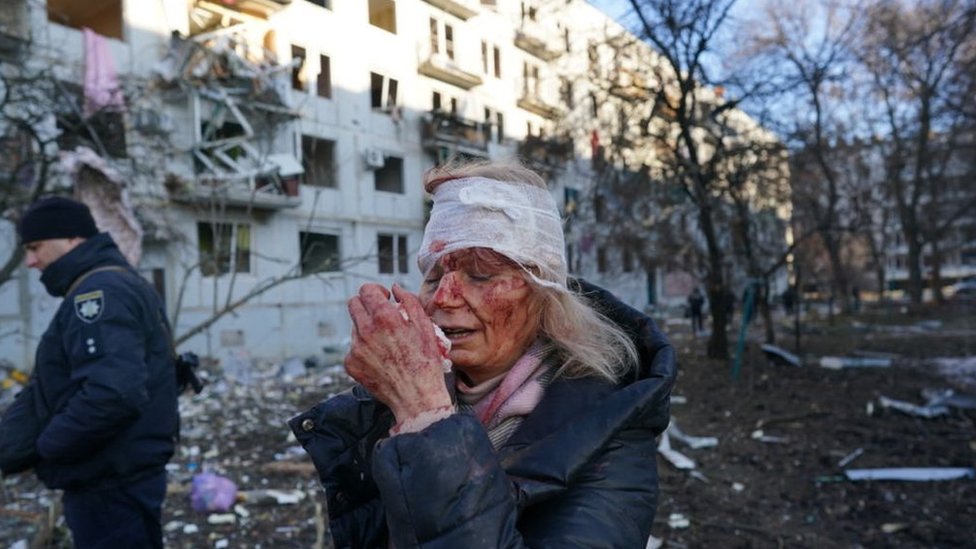 Una mujer herida a consecuencia de un ataque aéreo ruso en Járkov, en el este de Ucrania.