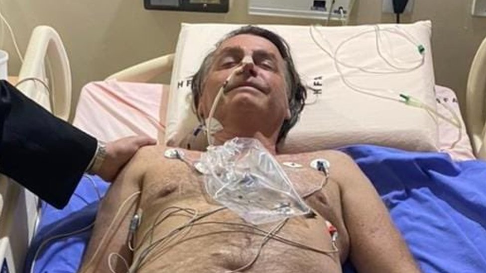 El presidente Jair Bolsonaro en el hospital