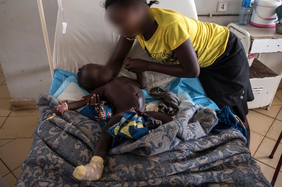 A young girl who lost her parents and was injured during the farmer-Fulani clashes is supported by her aunt in the paediatric ward of the Jos University Teaching Hospital on June 28, 2018.