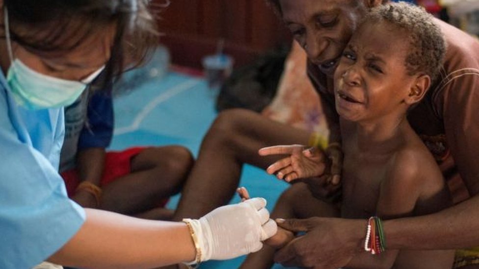 Медсестра лечит мальчика в Папуа.