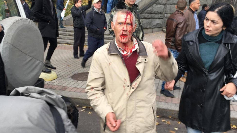 Чоловііку розбили голову