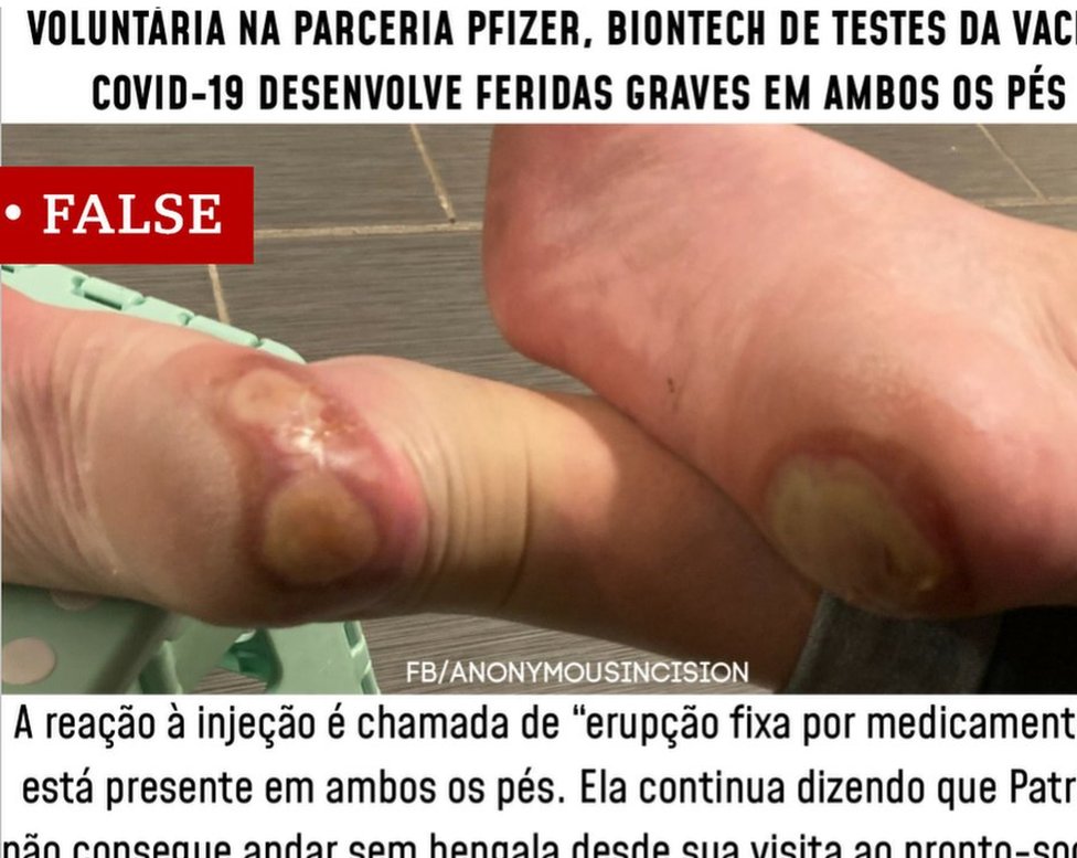 Post sobre os pés feito em portugues