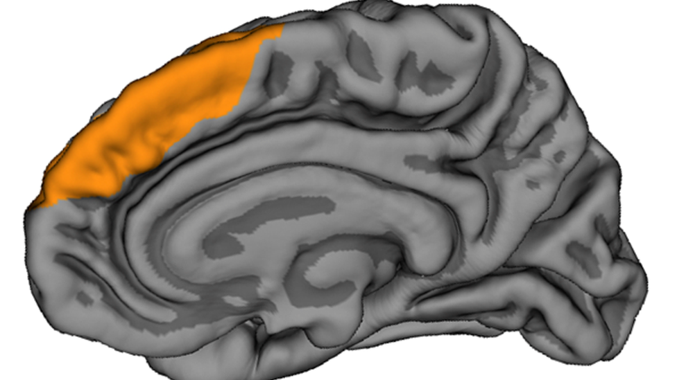 диаграмма мозга, показывающая расположение ПК