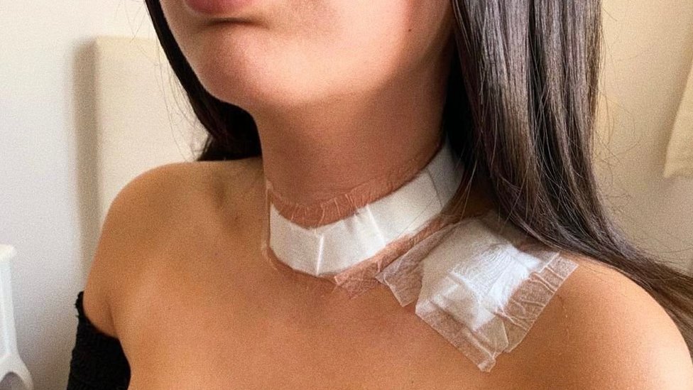 Gabriella Barboza muestra el cuello después de la cirugía