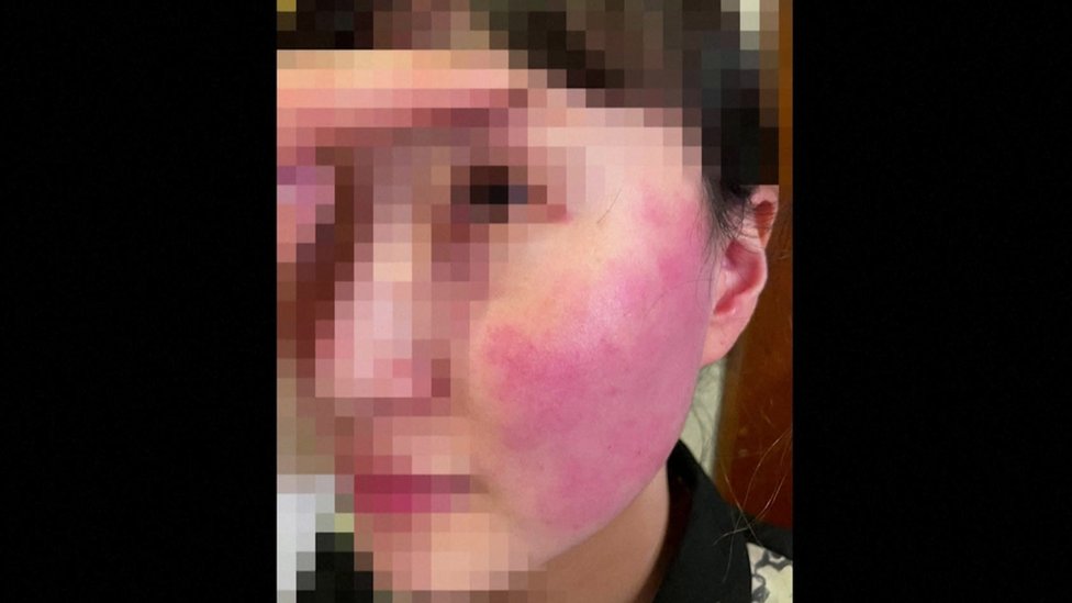 Blurred image of shop worker with swollen red face
