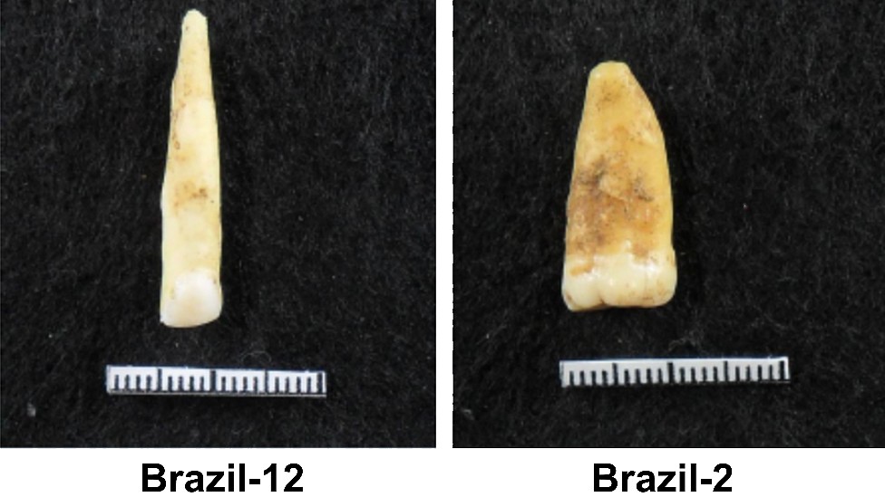 Duas fotos de dentes analisados