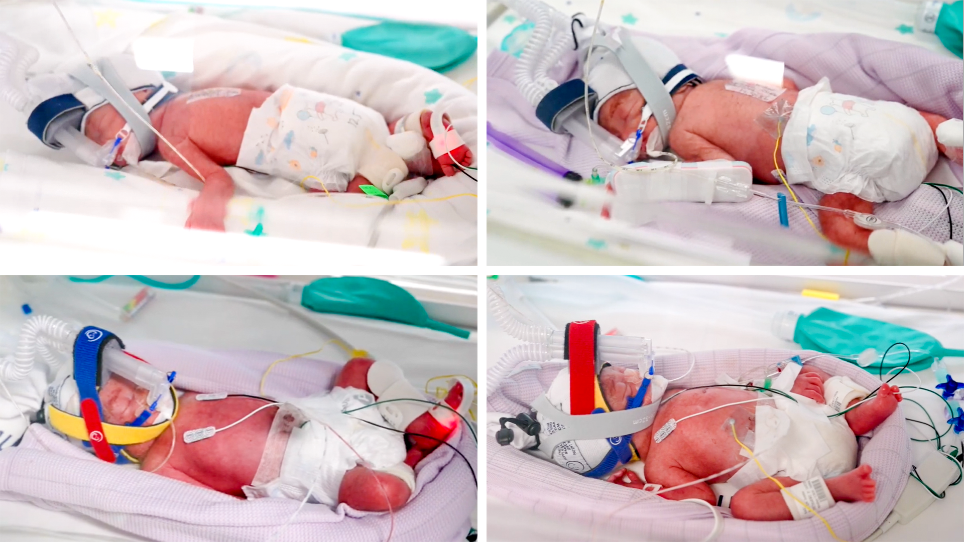 Brisbane mother delivered rare identical quadruplets in one-in-15-million pregnancy; babies born in Australia
