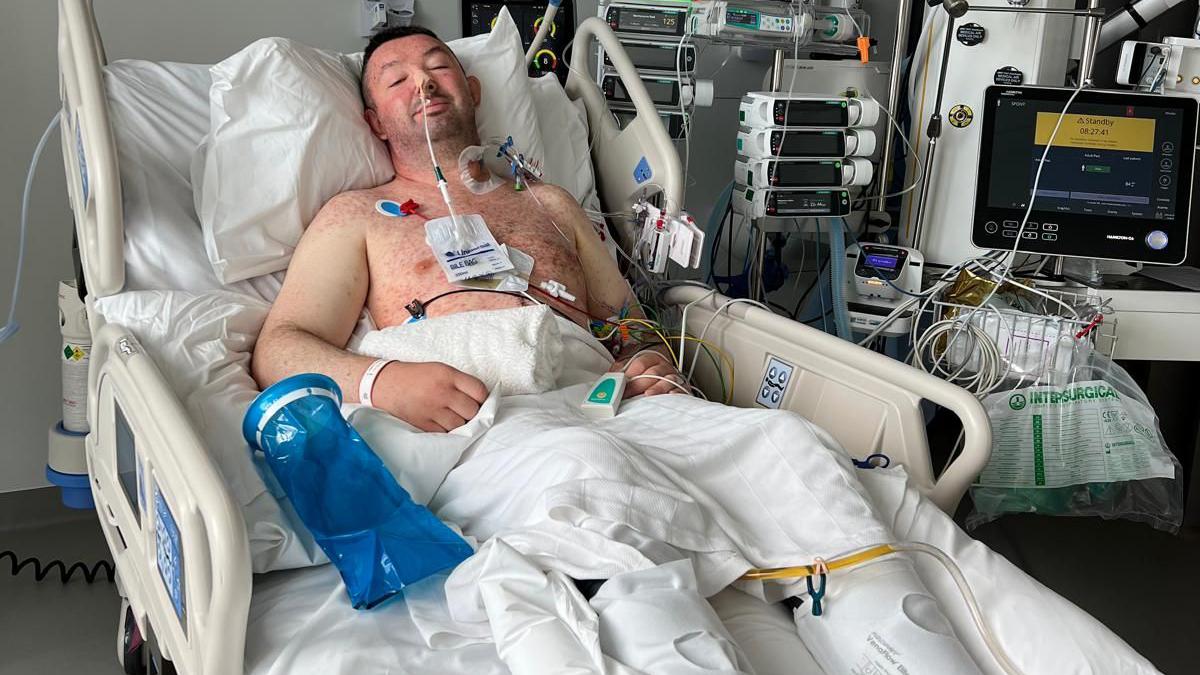 Bowel cancer patient issues warning about silent killer