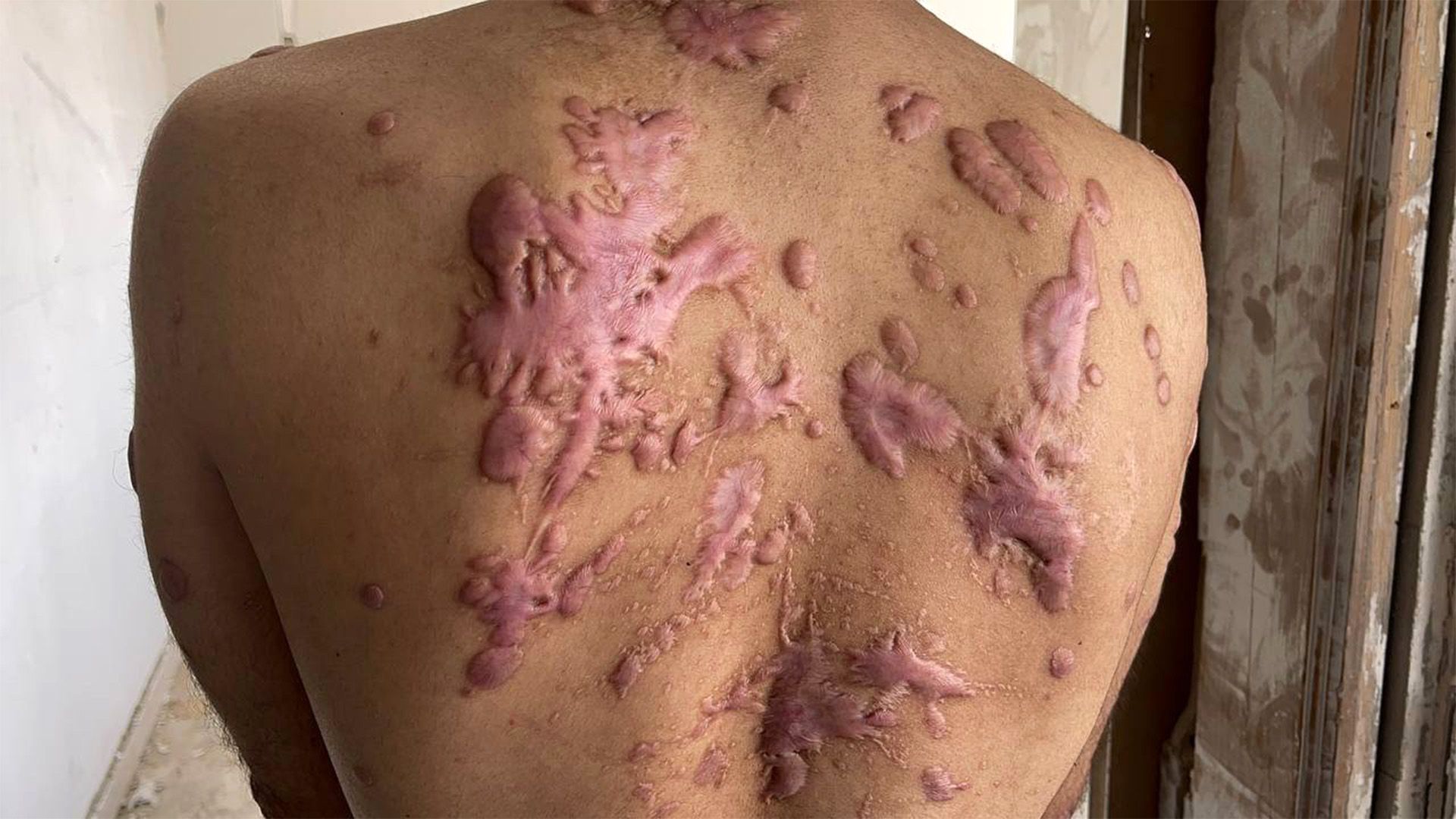 Vengriyalik qizlarni qattiq kaltaklash