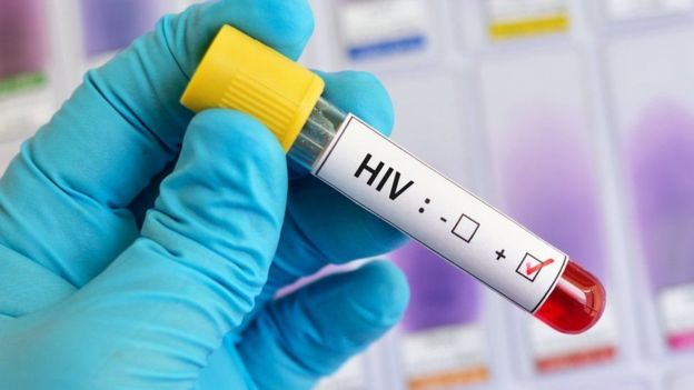 Tubo con sangre y una etiqueta que dice HIV