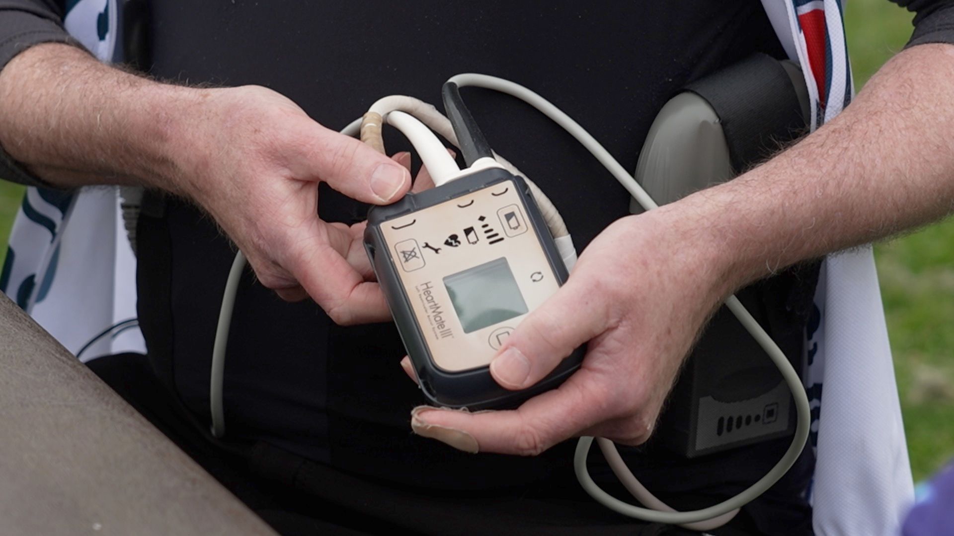 How LVAD heart pumps give patients years of extra life - BBC News