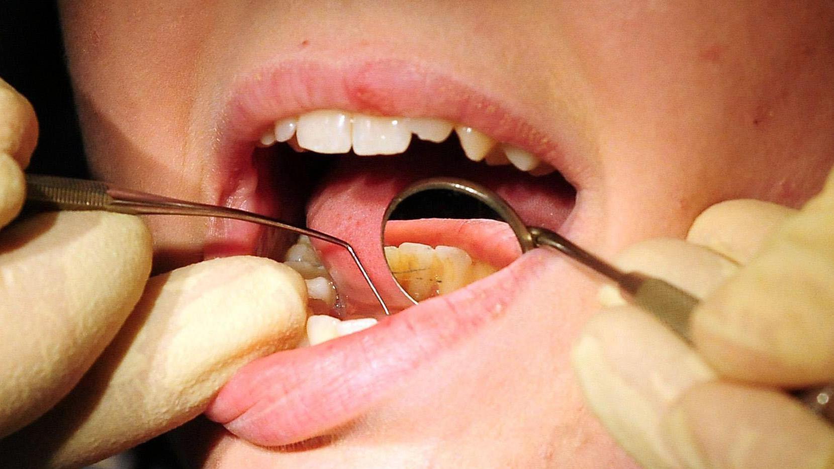 Dire lack of Barrow dentists prompts self medication