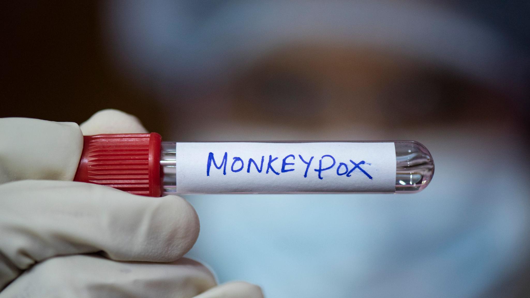 UK health agency identifies new Monkeypox strain in England
