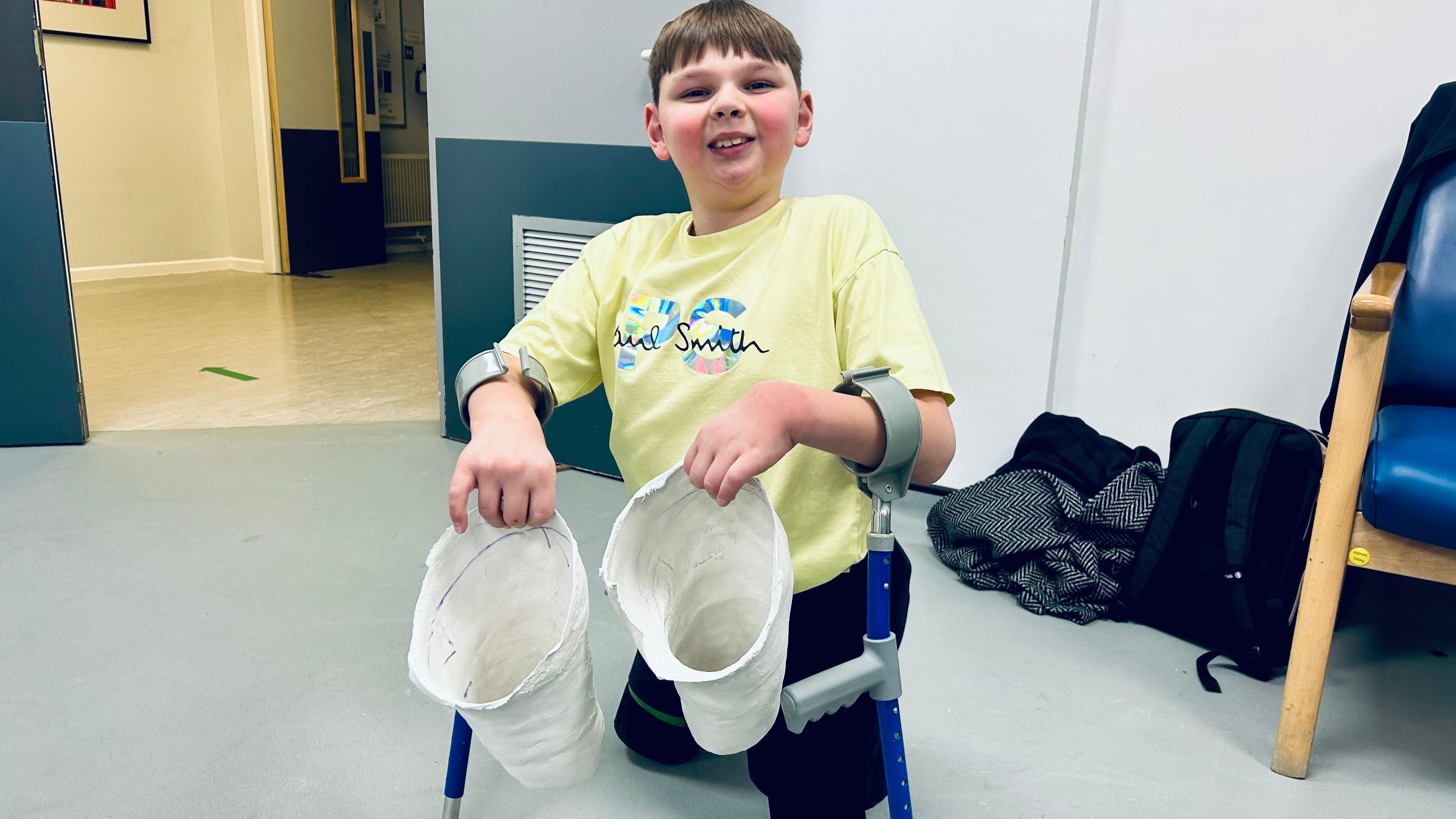 Double-amputee Tony Hudgell will be able to walk without crutches